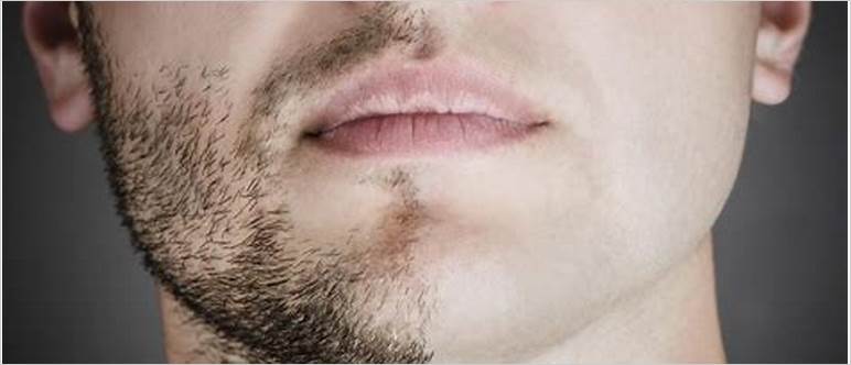 Crecimiento para la barba